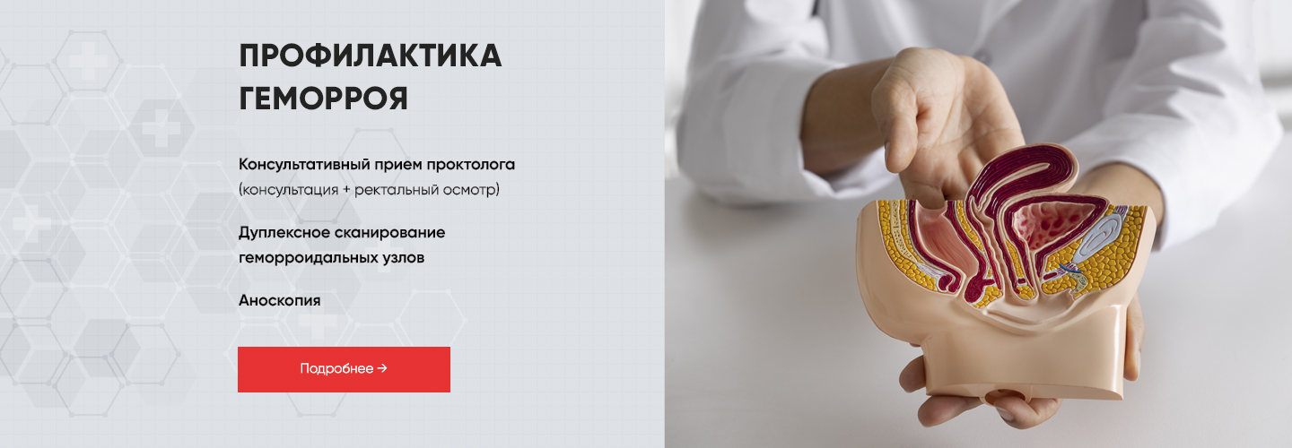 Профилактика геморроя